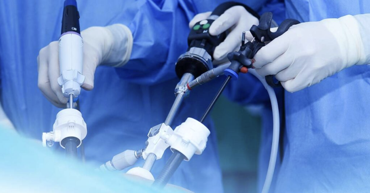 O Que é a Cirurgia Laparoscópica e Como Ela Funciona?